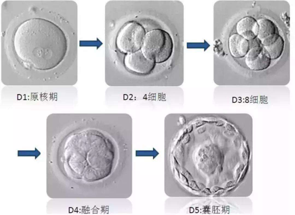 试管婴儿不能成功受精，该怎么办？
