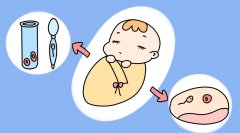 有遗传病可以做试管婴儿吗？三代试管婴儿，真正实现优生优育！