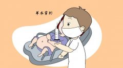 41岁高龄女性做美国三代试管适合做羊水穿刺吗？
