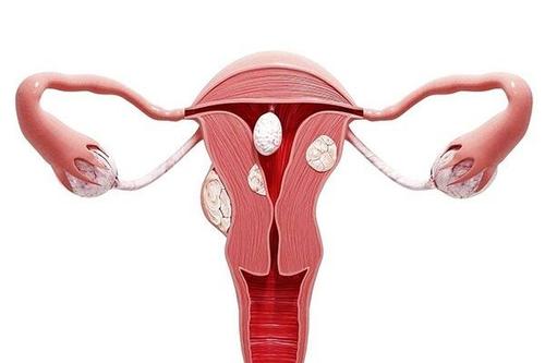  诺优笙国际：宫颈白斑影响美国试管婴儿成功吗？