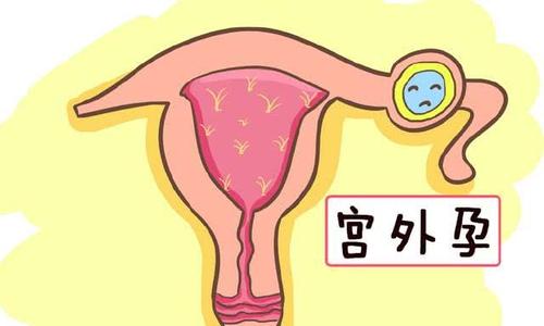  诺优笙国际：美国试管能避免宫外孕吗？如何做提高试管成功率？